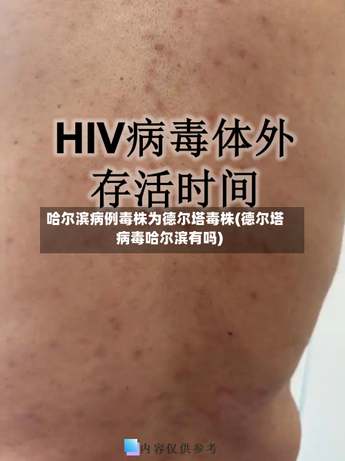 哈尔滨病例毒株为德尔塔毒株(德尔塔病毒哈尔滨有吗)-第2张图片