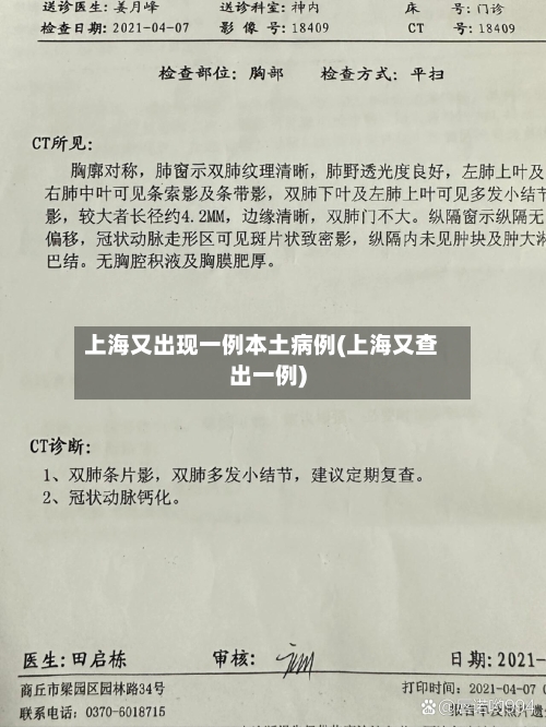 上海又出现一例本土病例(上海又查出一例)-第2张图片